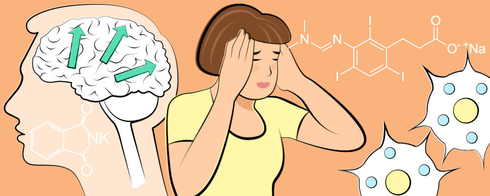 Eine brünette Frau die die Hände an den Kopf hält um anzuzeigen, dass sie eine Migräneattacke hat, sowie ein menschliches Gehirn in dem durch grüne Pfeile das Fortschreiten einer Migräne dargestellt wird.
