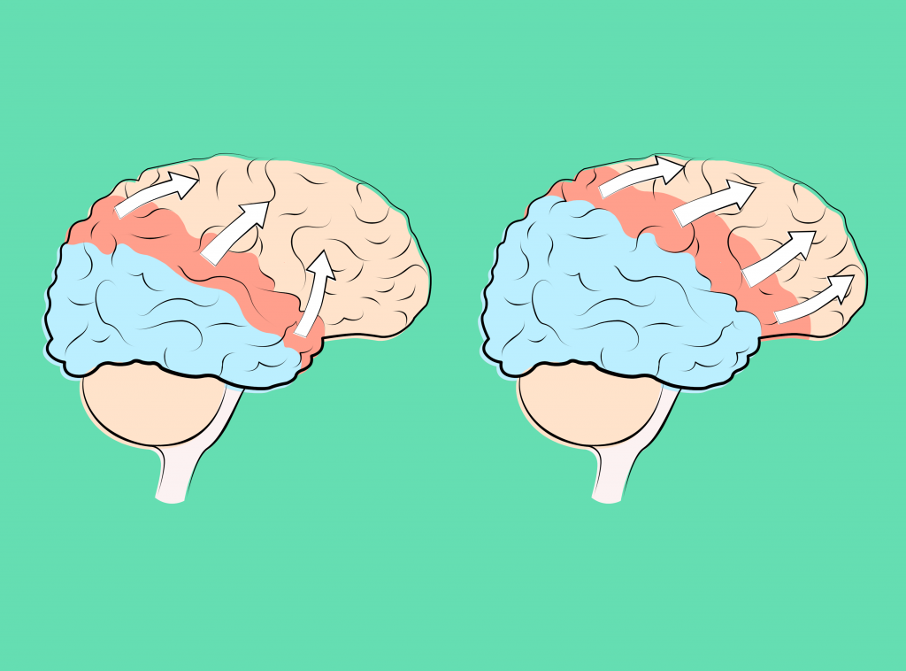 Zwei menschliche Gehirne vor grünem Hintergrund, die teilweise blau und rot markiert sind um das Fortschreiten der Cortical Spreading Depression darzustellen.