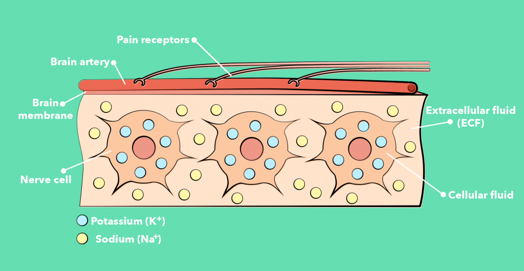 An illustration of the normal brain, with nerve cells surrounded by the extracellular fluid (ECF). The brain is surrounded by the brain membrane, and lying on top of this membrane are the arteries supplying the brain with blood. The arteries have pain receptors. The concentration of K+ is high inside the cells and low outside in the ECF. For Na+, it is the other way around.